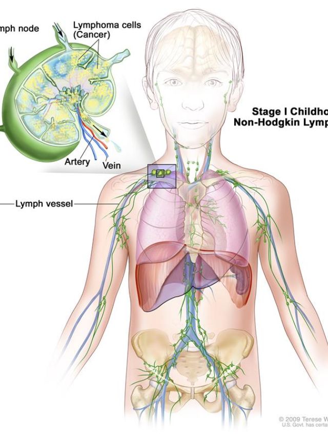Lymphoma Therapeutics: Emerging Trends and Innovations